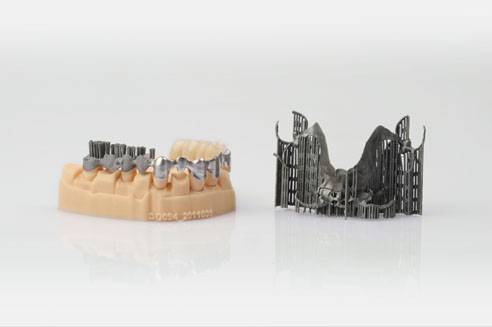 Dentiers adsorpants amovibles à dents artificielles à col plein supérieur  et inférieur Dents de la voûte plantaire - Chine Laboratoire dentaire CNC  prothèses dentaires, prothèses dentaires implantées Fabricant