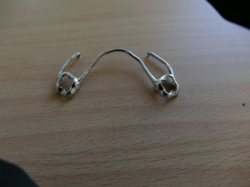 Orthodontie, bagues, disjoncteurs, appareils etc....