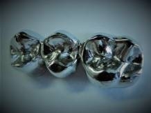 Notre zone d'activité pour ce service Fabricant de bridges dentaires